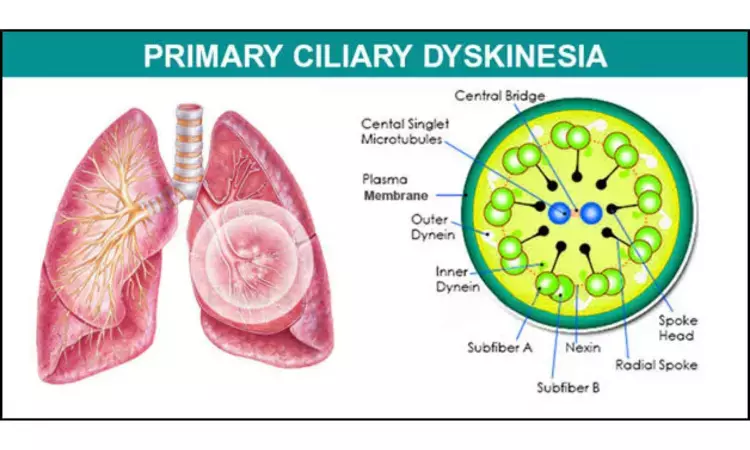 Advances in the Diagnosis and Treatment of Primary Ciliary Dyskinesia- A Review