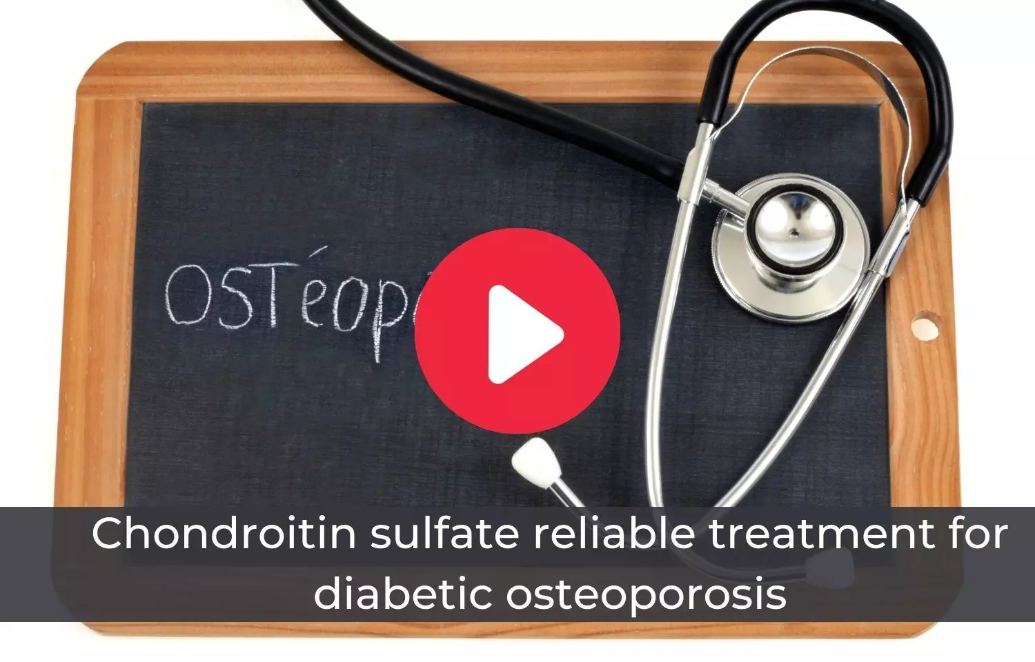 Chondroitin sulfate reliable treatment option for diabetic osteoporosis patients