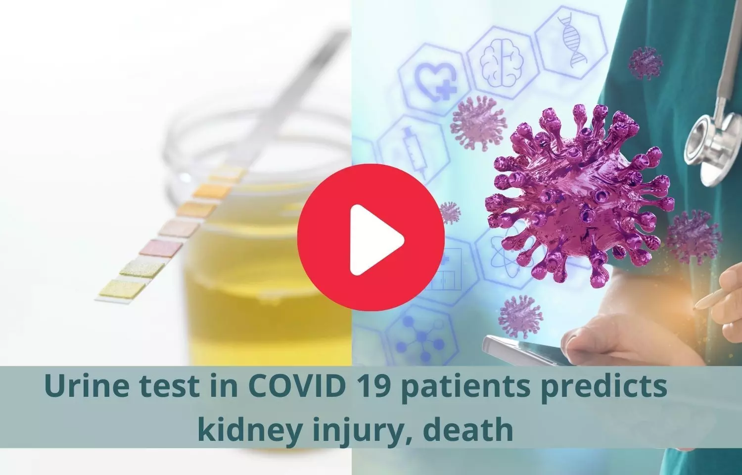 Urine test in COVID patients predicts kidney injury, death