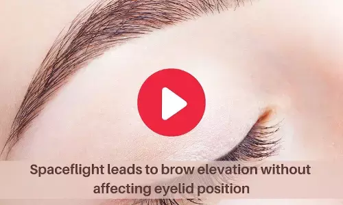 Spaceflight can cause brow elevation without eyelid position change