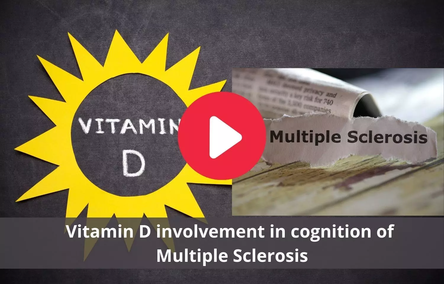 Vitamin D involvement in cognition of Multiple Sclerosis