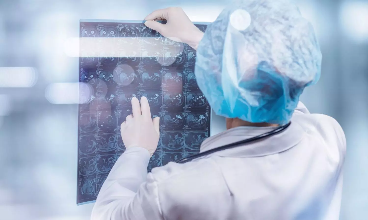 Both AI and radiologists can get fooled by tampered medical images, study finds