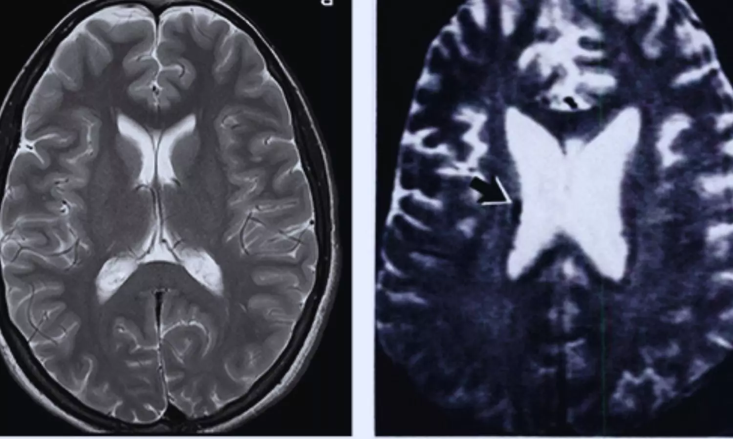 Researchers develop low-cost mobile MRI machine for detecting brain disorders