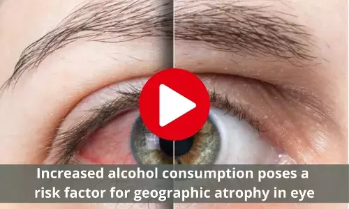 Increased alcohol consumption poses a risk factor for geographic atrophy in eye