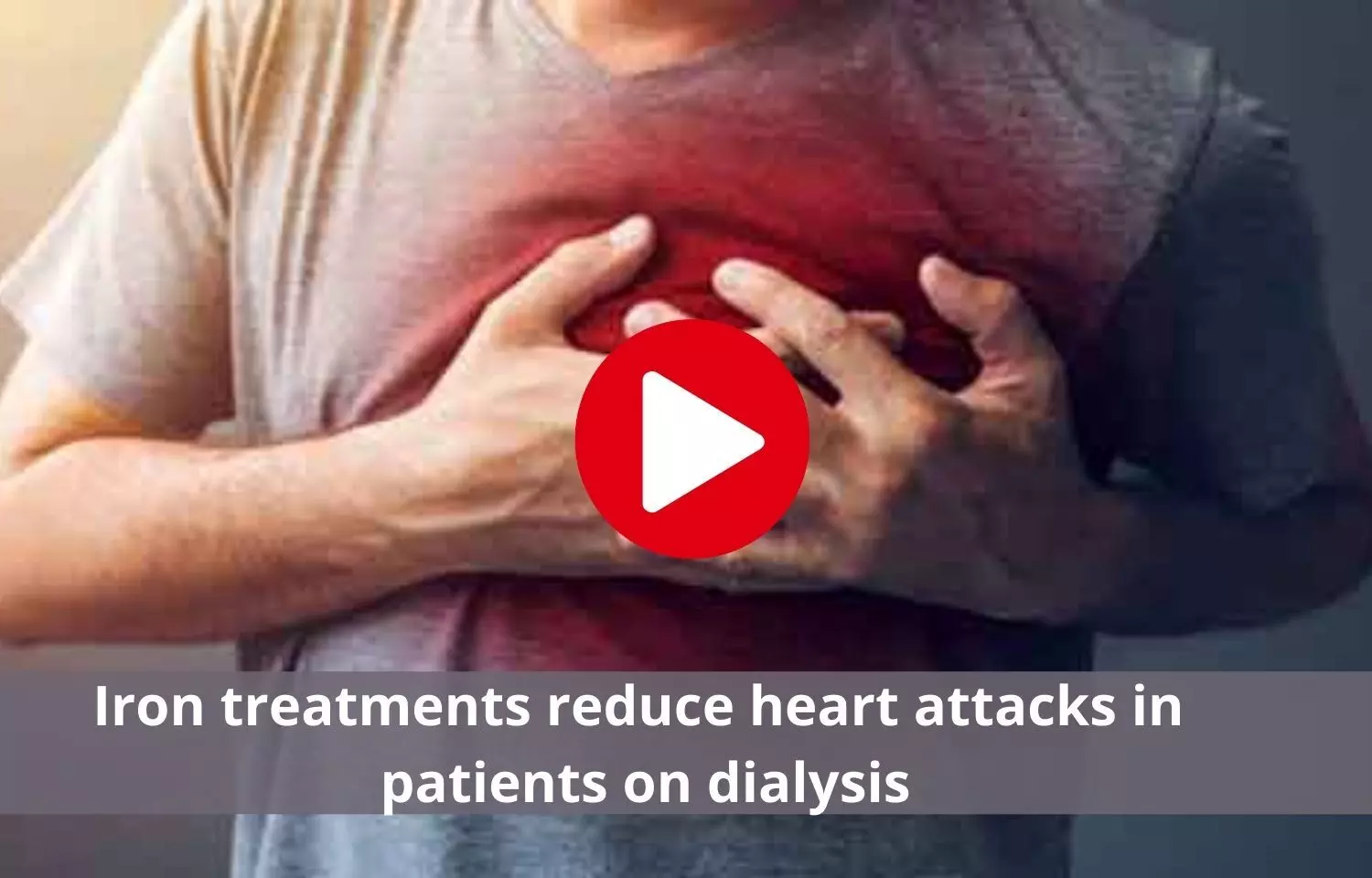 Treatment with iron decreases heart attack incidence in dialysis patients