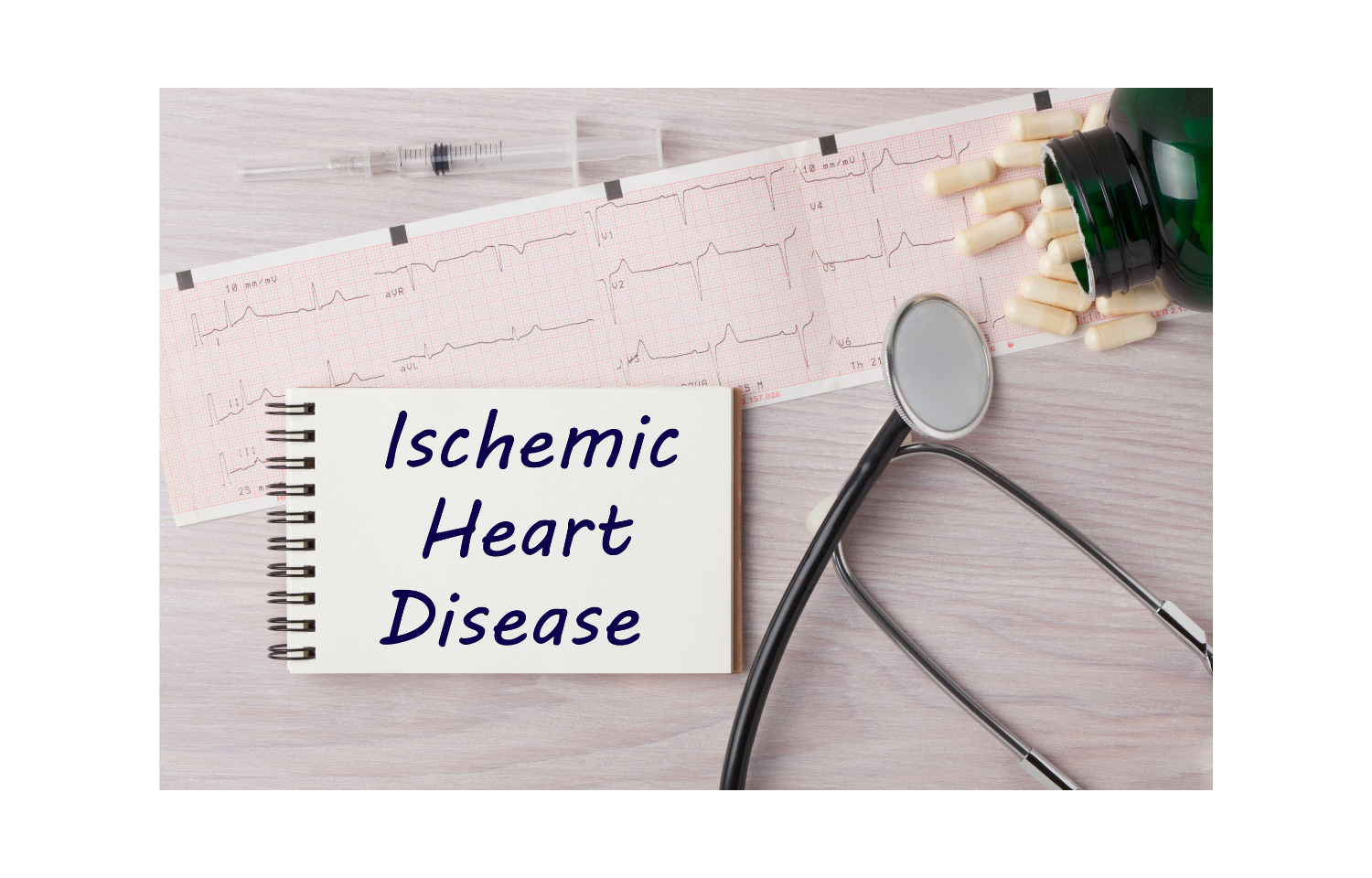 Absence of symptoms in Stable Ischemic Heart Disease predicts ...