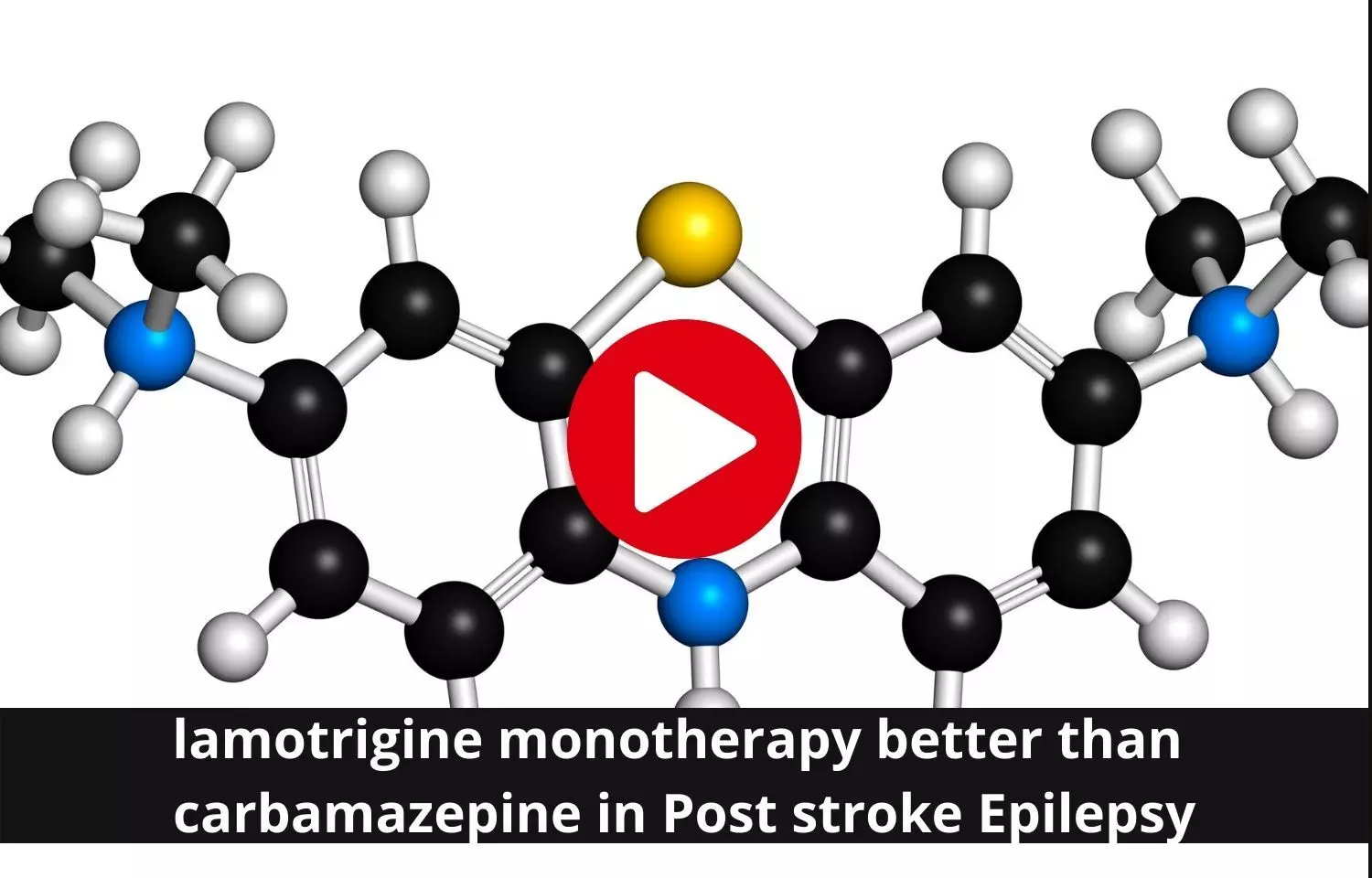 Iamotrigine monotherapy overpowers carbamazepine in post stroke epilepsy