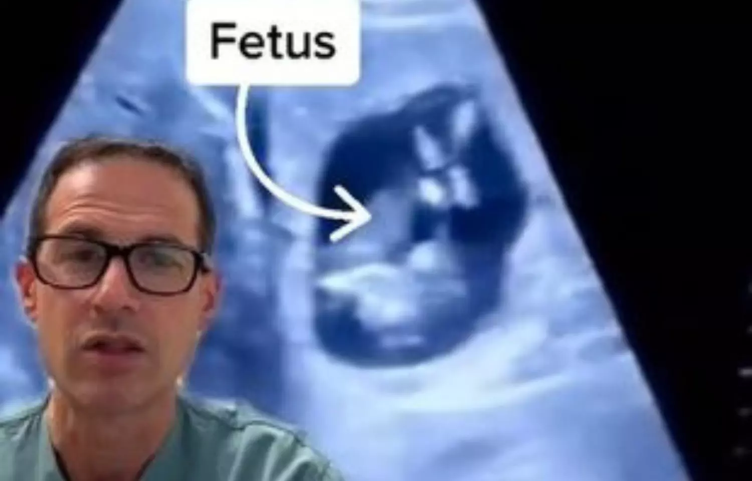 Viral Video of Ectopic Pregnancy with baby in liver draws million views