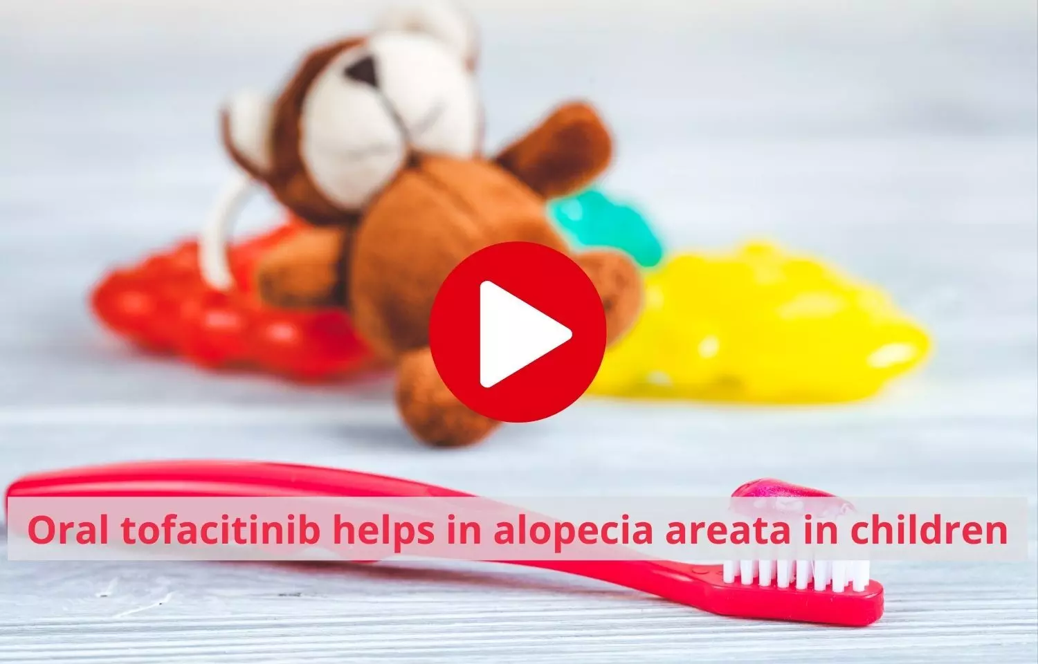 Oral tofacitinib helps in alopecia areata in children