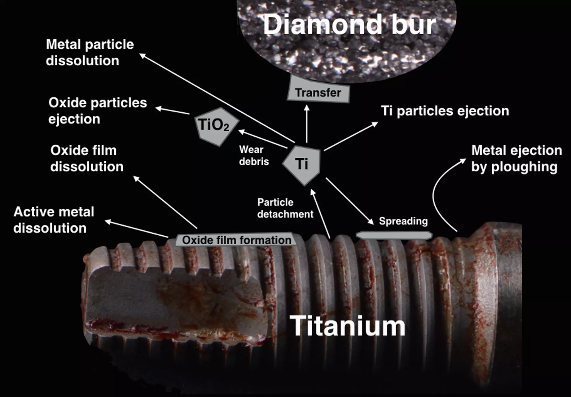 Commercially pure titanium debris  may induce carcinogenic effects on peri-implant tissues: Study
