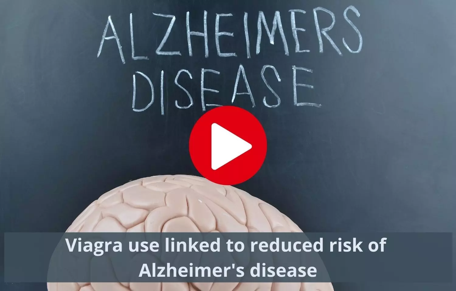 Viagra use tied to reduced Alzheimers disease risk