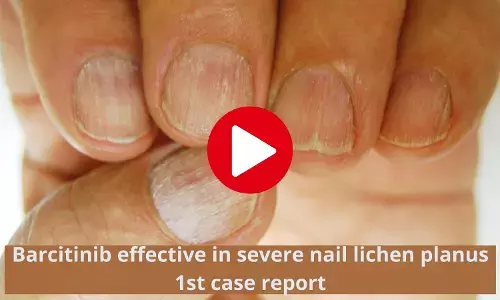 Barcitinib effective in severe nail lichen planus-1st case report
