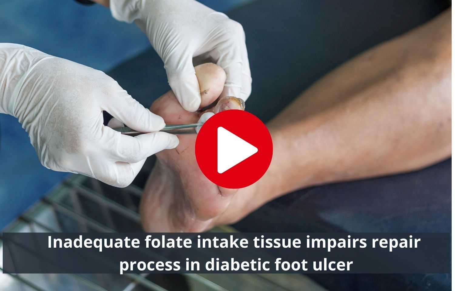 Inadequate folate intake compromises the repair process in diabetic ...