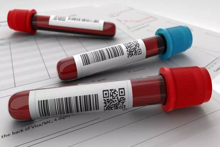 Complete blood count test, a cost-effective tool to monitor glycemic control in type 2 diabetes: Study