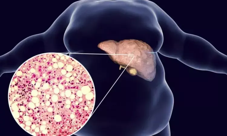 Loneliness and social isolation linked to increased risk of non-alcoholic fatty liver disease, study finds