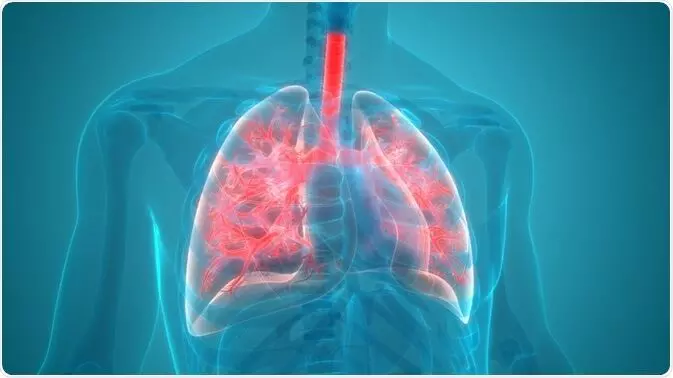 Additive systemic corticosteroid therapy is negatively associated in severe pneumonia:  Study