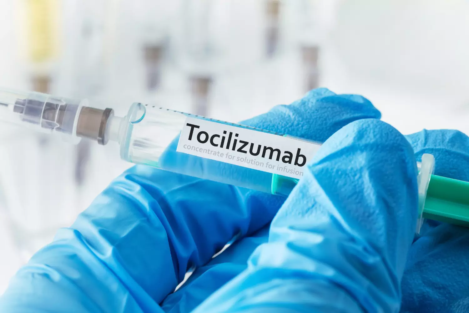 When to Start Tocilizumab in Moderate to Severe COVID 19 Patients?
