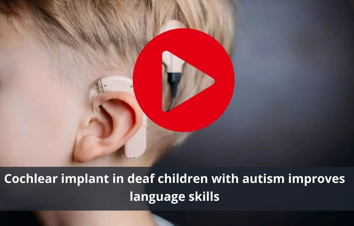 Deaf children with autism improved language skills with cochlear implant