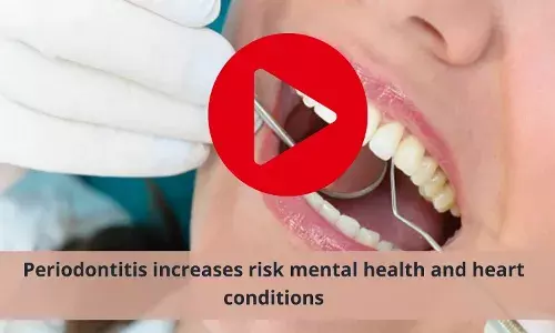 Risk of mental health and heart conditions higher with Periodontitis