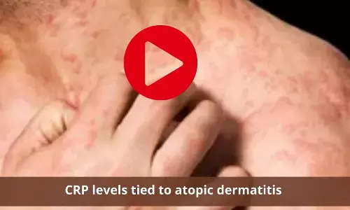 Atopic dermatitis to be related to higher levels of CRP