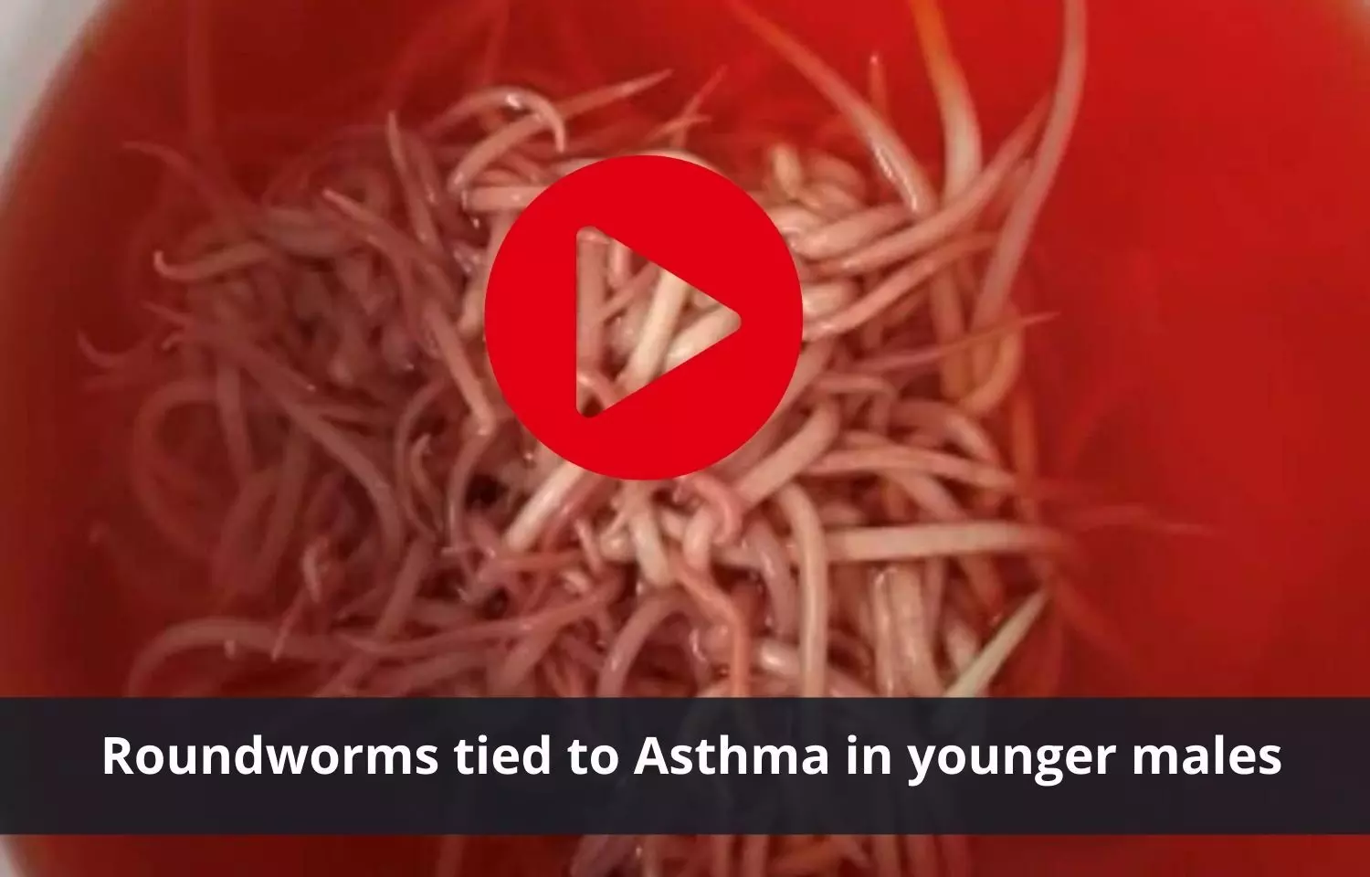 Asthma in younger males reduced by roundworms