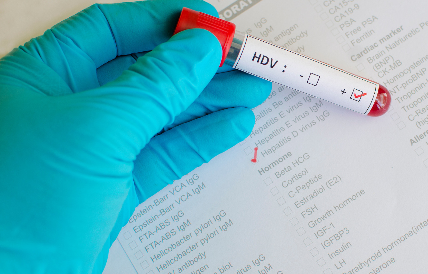 Karkinos Healthcare launches HPV test CerviRaksha priced at Rs 2499