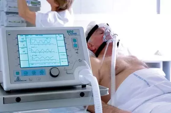 Expert Opinion on Post Extubation Oxygenation Strategies in Critically Ill & Postop Patients