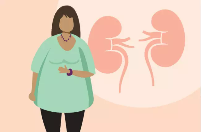 Obesity may increase end-stage kidney disease risk in women with type 2 diabetes