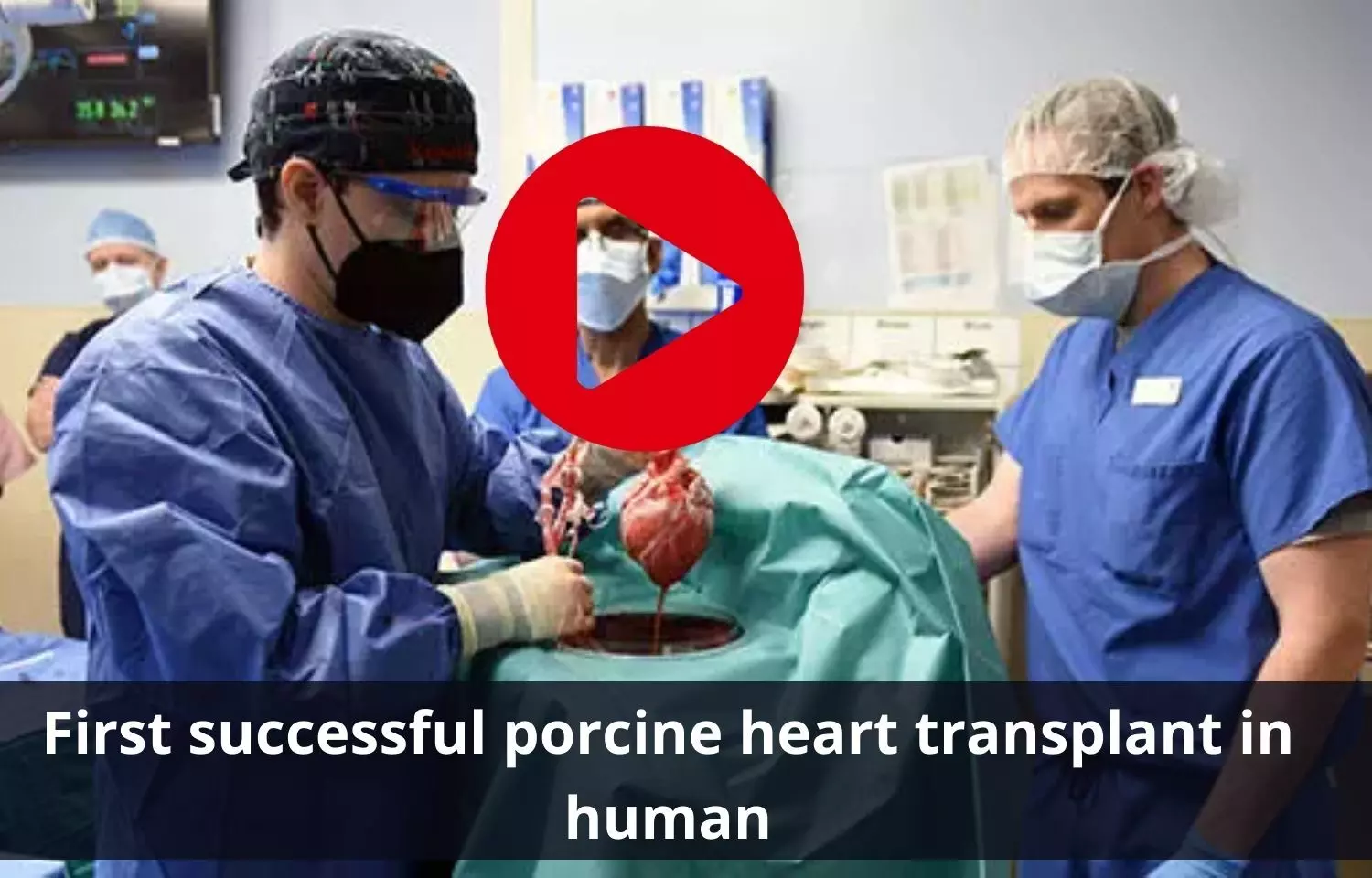 First successful Xenotransplant: porcine heart transplant in human