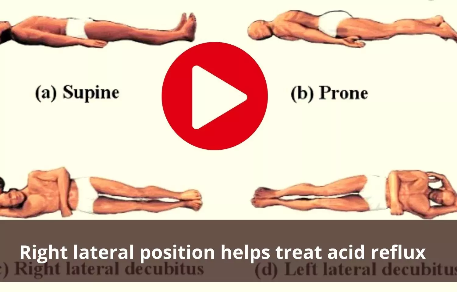 Proper sleeping position helps to treat acid reflux
