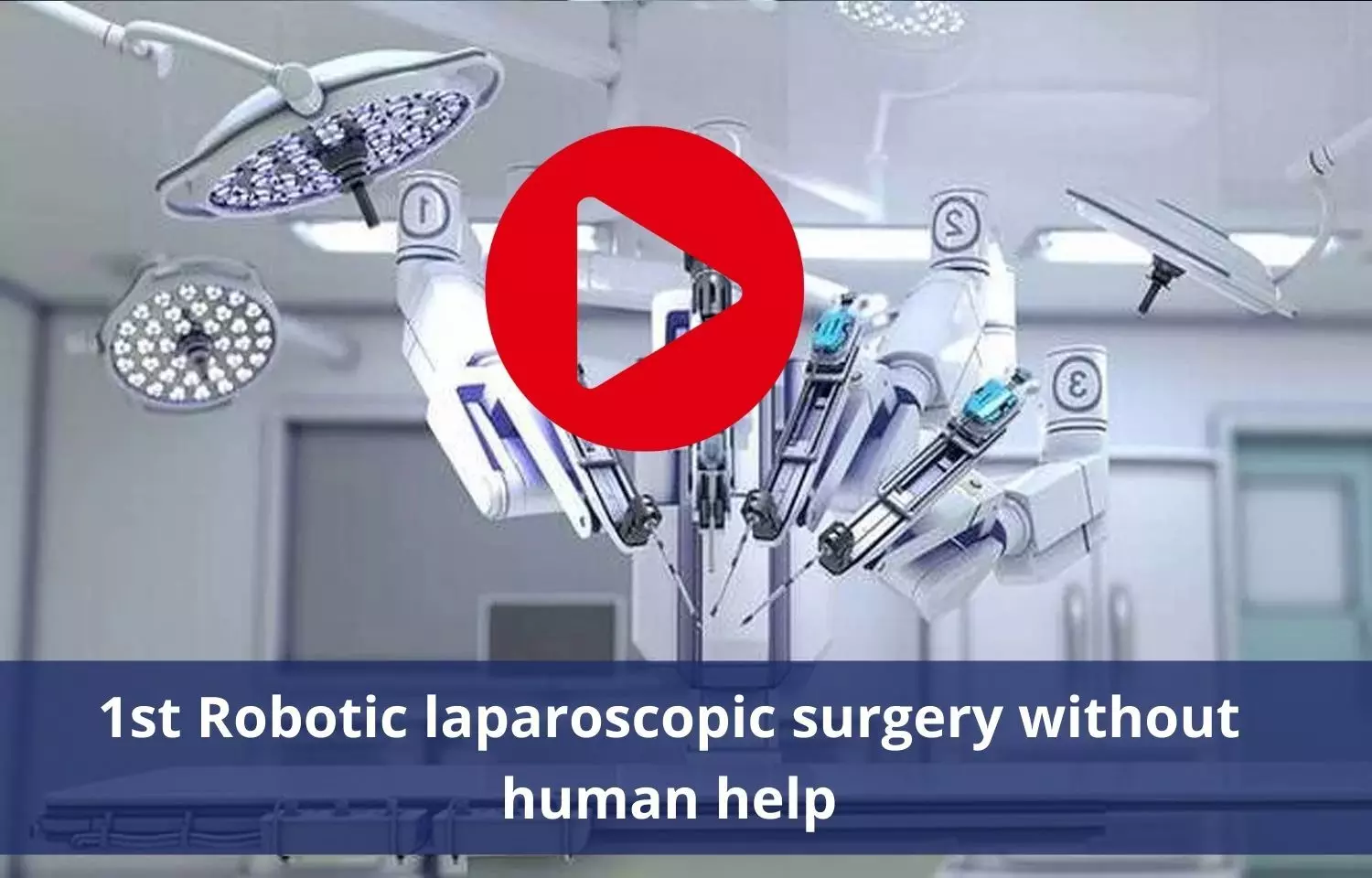 First Robotic laproscopic surgery successful without human help