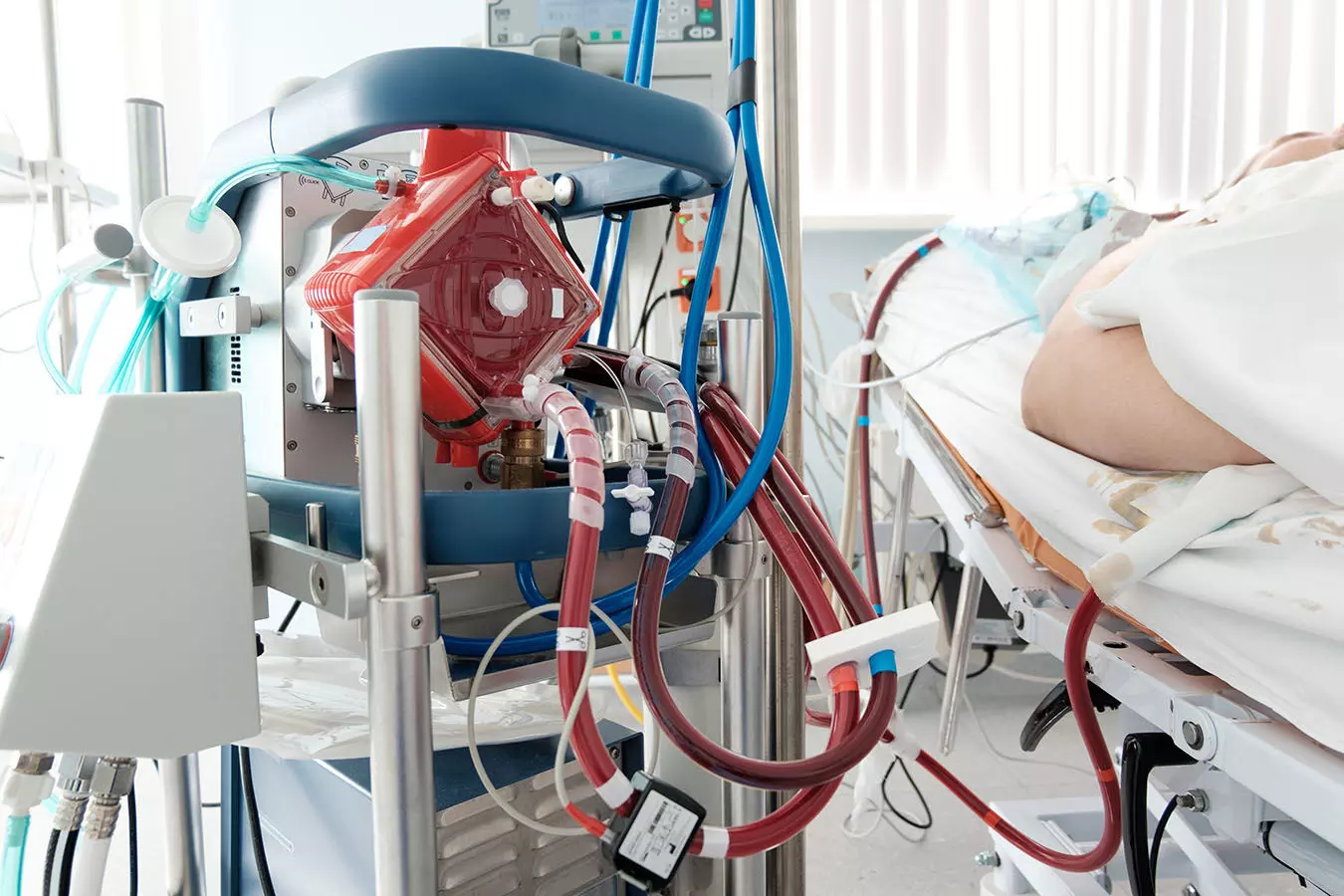 ECMO use linked to increased risk of mental health and social issues: JAMA