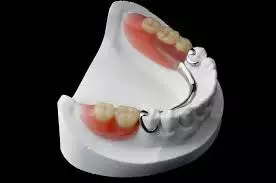 Selection of cast and wrought-wire clasps for removable partial dentures: Guideline