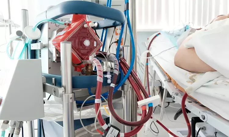 ECMO use linked to increased risk of mental health and social issues: JAMA