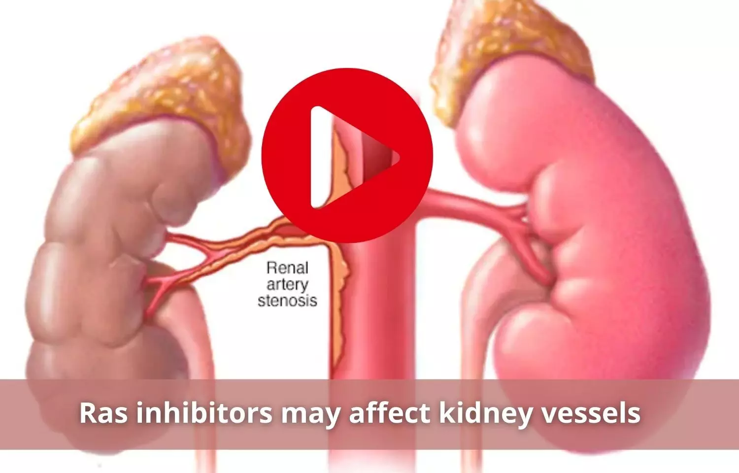 Ras inhibitors affects kidney vessels to greater extent