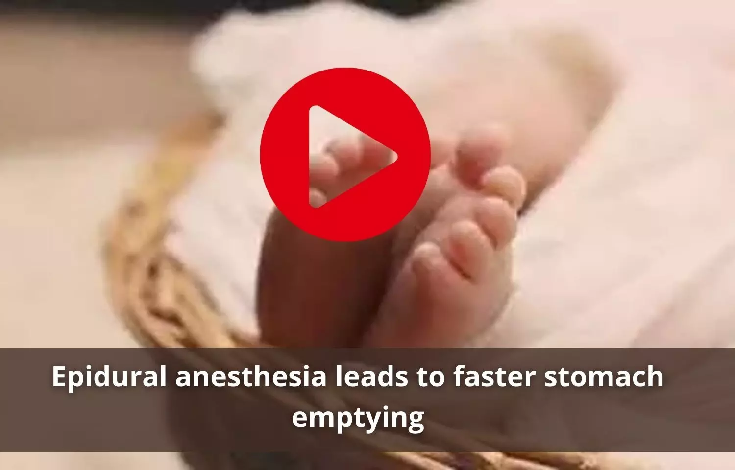 Epidural anesthesia helps faster stomach emptying during labour