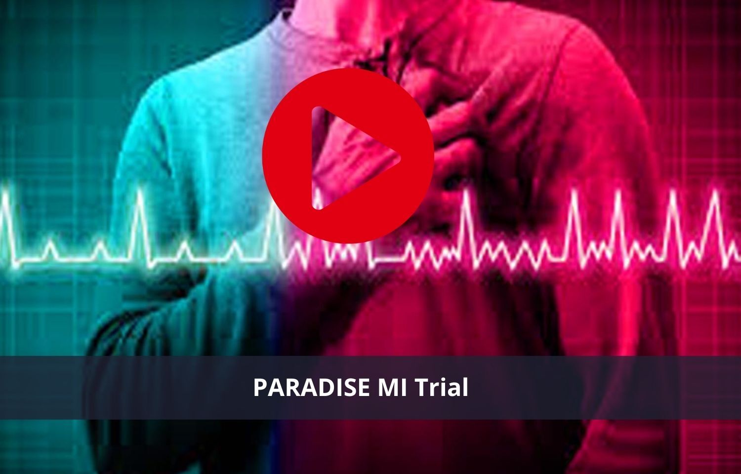 PARADISE MI Trial sacubitril/valsartan effective for heart attack