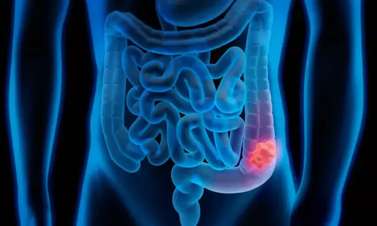 Periodontal disease associated with increased risk for sporadic colorectal cancer: Study