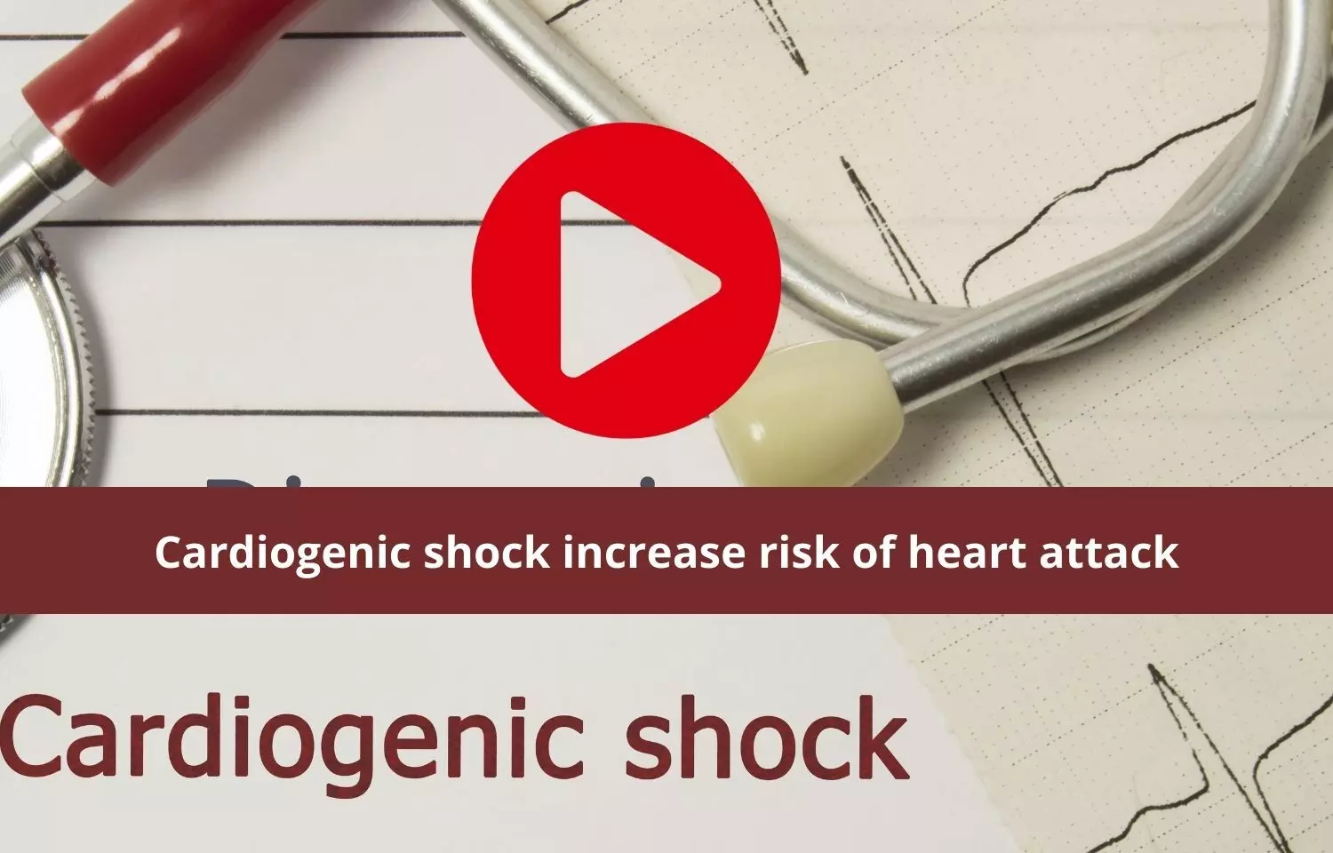 Cardiogenic shock a serious risk of heart attack