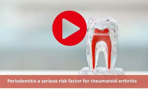 Periodontitis; Severe risk factor for rheumatoid arthritis