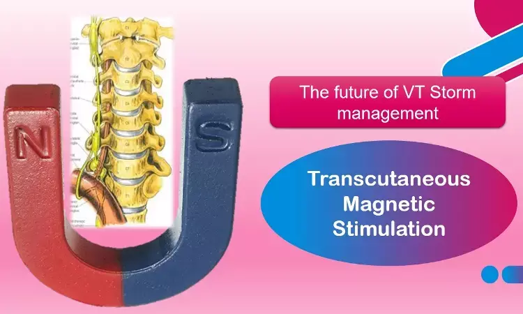JAMA study suggests novel treatment strategy for VT storm: Transcutaneous magnetic stimulation.