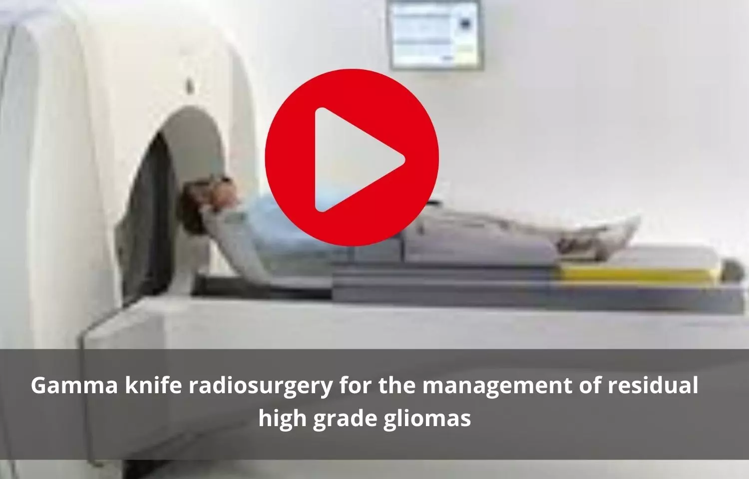 Gamma knife radiosurgery to manage high grade gliomas