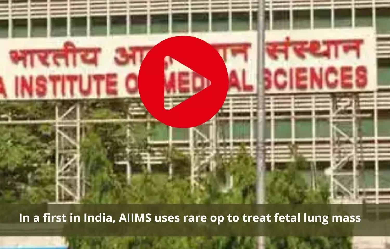 For first time, 27 weeks old fetus suffering from huge lung mass successfully treated at AIIMS Delhi