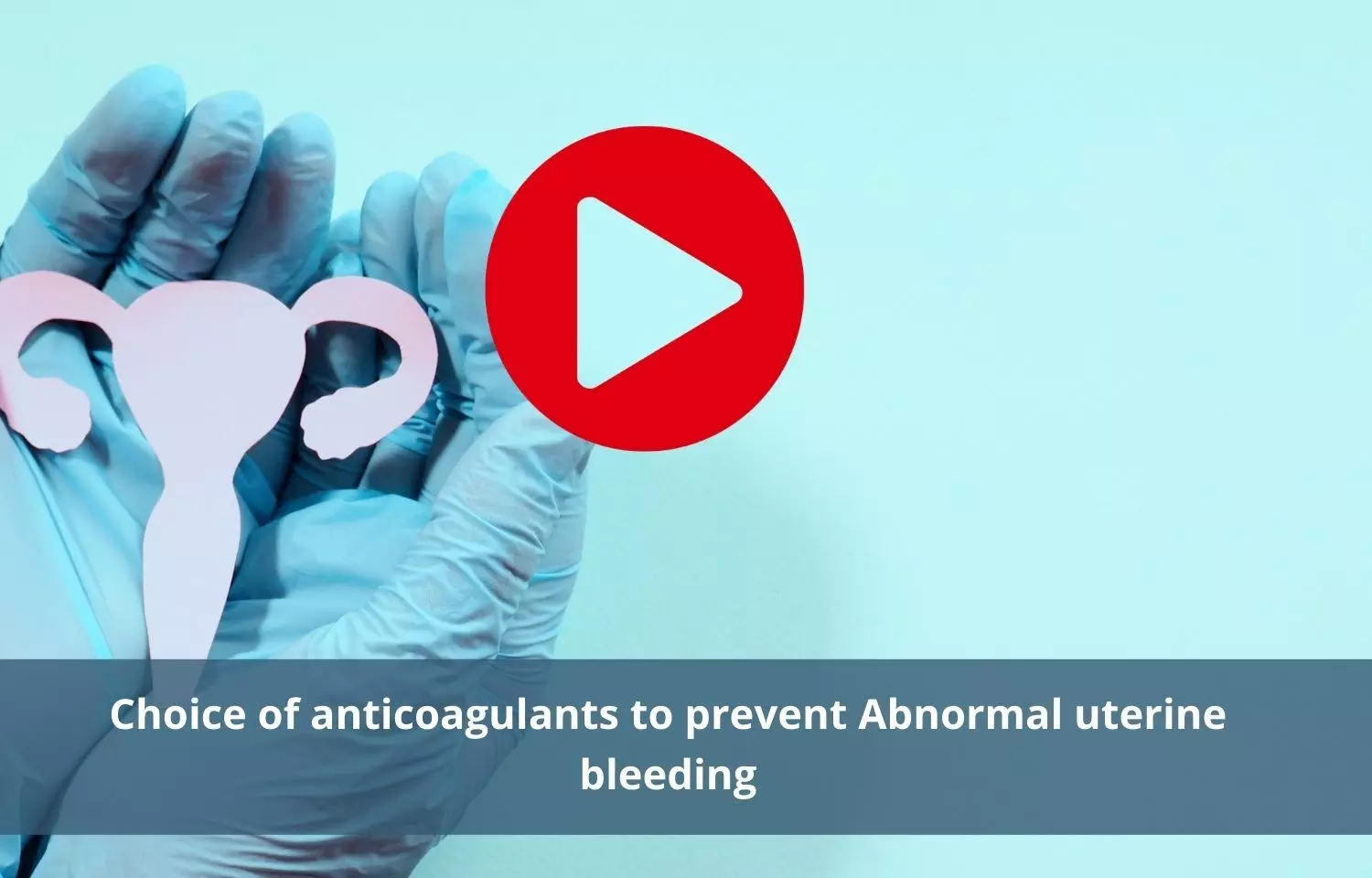 Choosing anticoagulants to prevent Abnormal uterine bleeding is essential