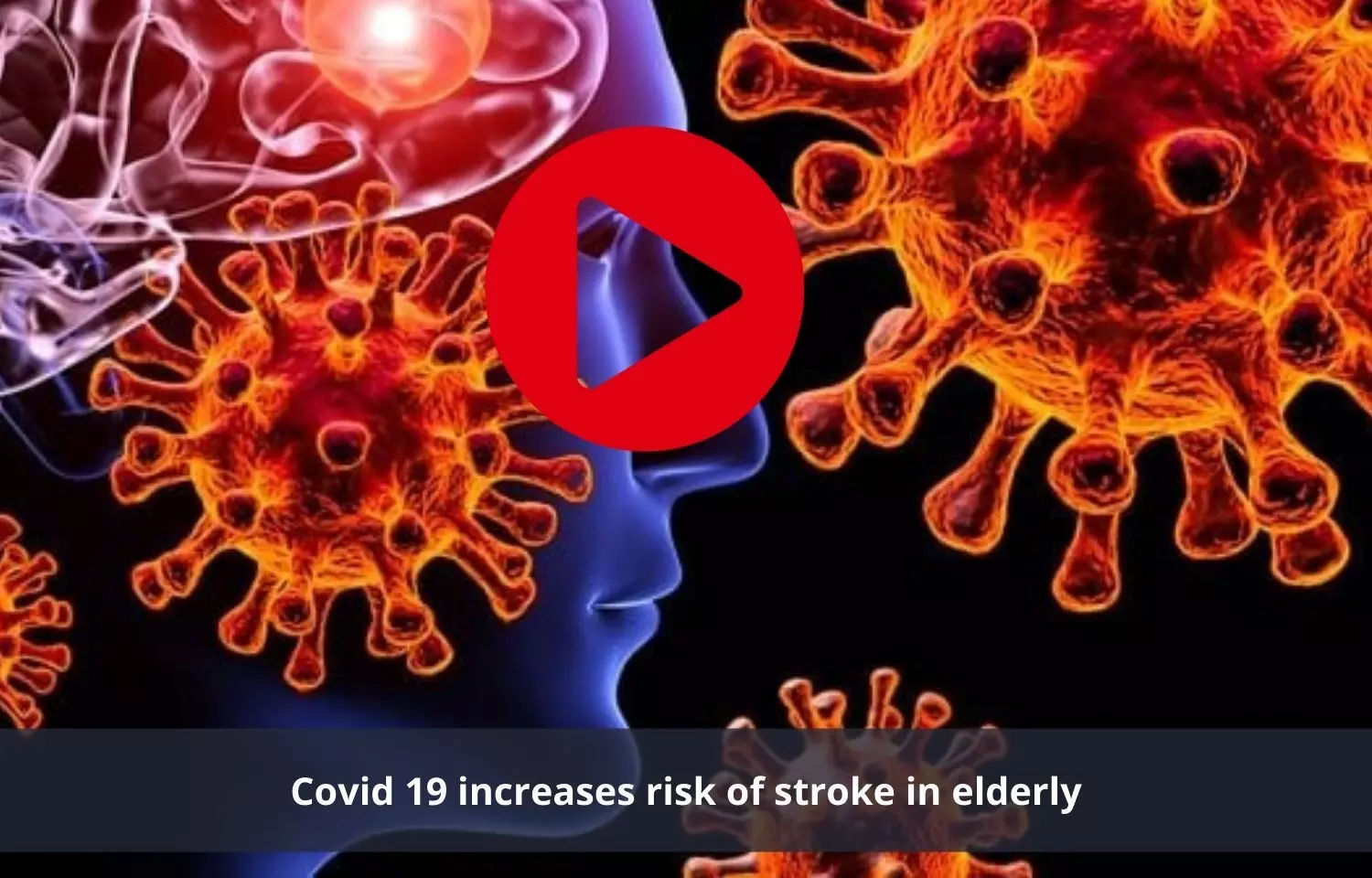 Covid 19 to be a cause of stroke in elderly