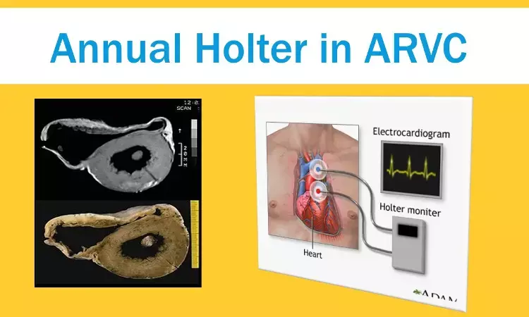 Annual Holter monitoring helpful in future arrhythmia risk assessment in ARVC patients, JAMA