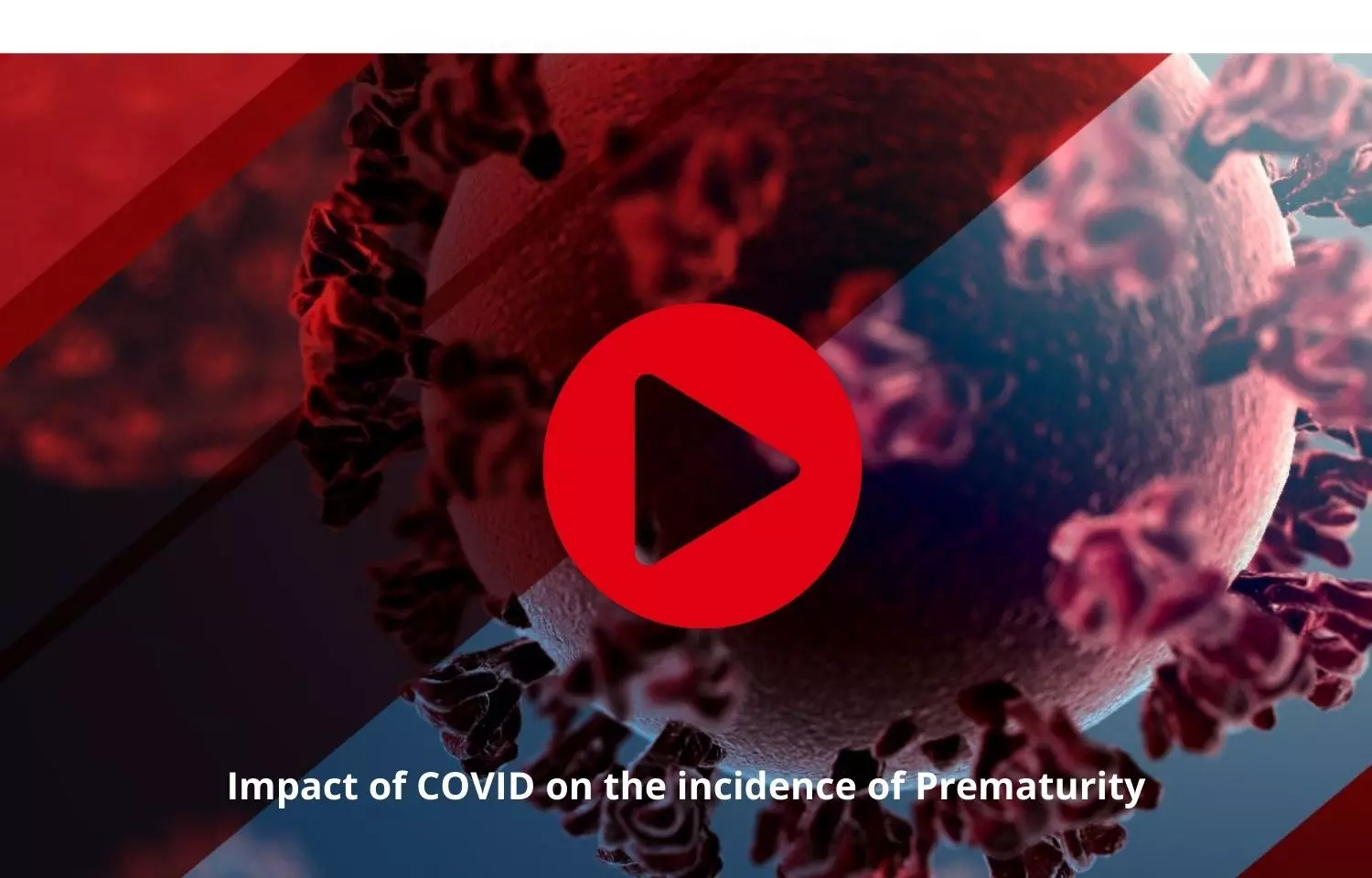 COVID to influence the incidence of Prematurity