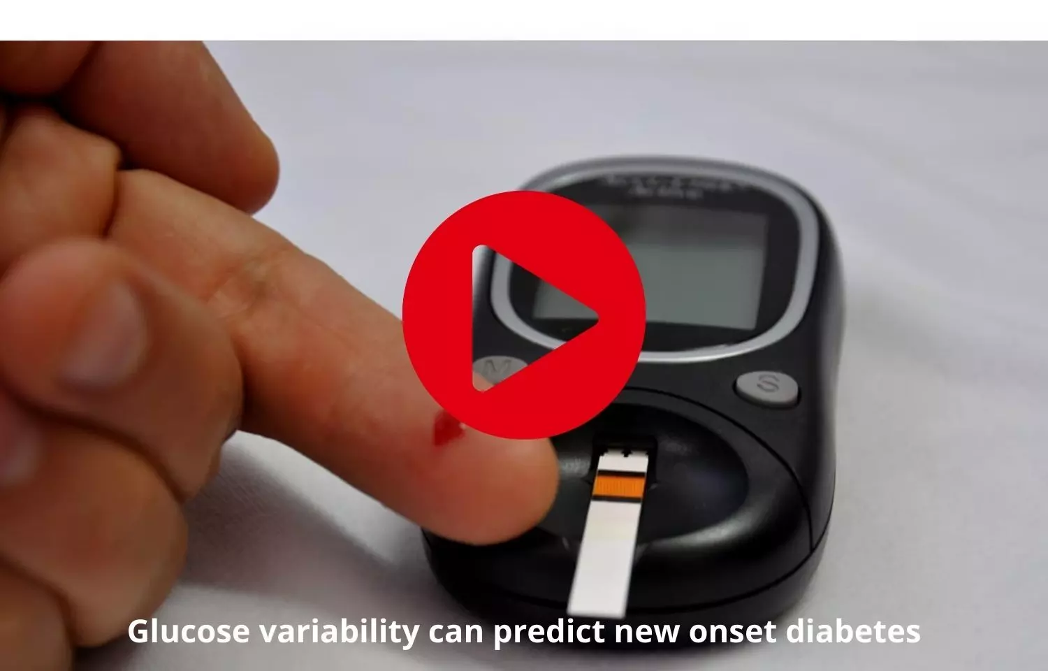 Glucose variability to predict new onset of diabetes