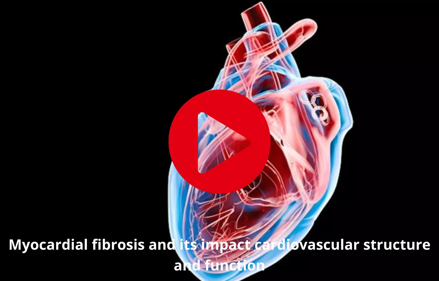 Myocardial fibrosis to affect cardiovascular structure and function