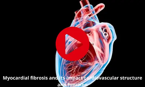 Myocardial fibrosis to affect cardiovascular structure and function